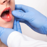 Oral Cancer Screening Burtonsville, MD