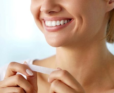 Can Whitening Strips Damage Porcelain Veneers