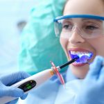 Dental Bonding-The Smile Shapers Dentist Ventura