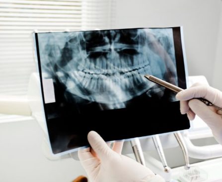 Dental Exams in Salt Lake City, UT