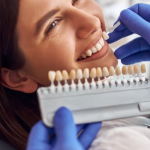 Dental Veneers in Pasadena, CA