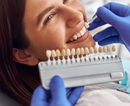 Dental Veneers in Pasadena, CA