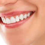 Dental Shapes- The Smile Shapers Dentist Ventura