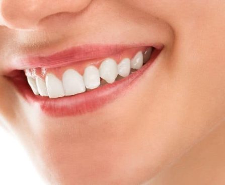 Dental Shapes- The Smile Shapers Dentist Ventura