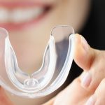 Night Guards Havertown Dental Arts