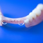 Partial Dentures-The Smile Shapers Dentist Ventura