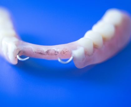 Partial Dentures-The Smile Shapers Dentist Ventura