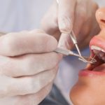 Selecting a Top Dentist in Rocklin